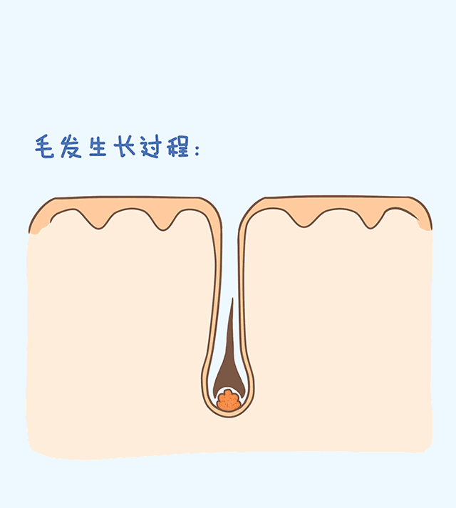 雷射除毛要做幾次才能持久除毛?